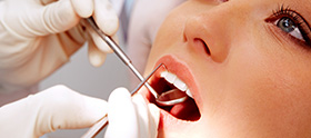 Periodontal Disease